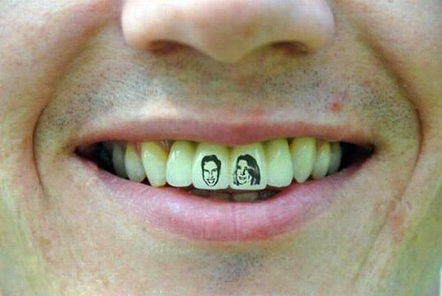 Кариес? Не, показалось...