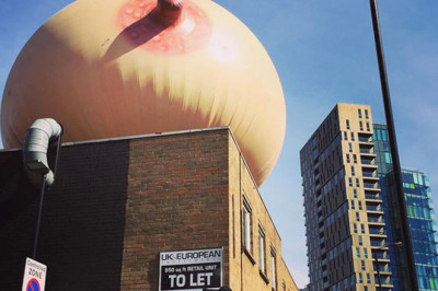 Негабаритная анатомия 