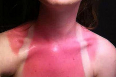 Не забывайте , что загорать надо с умом !