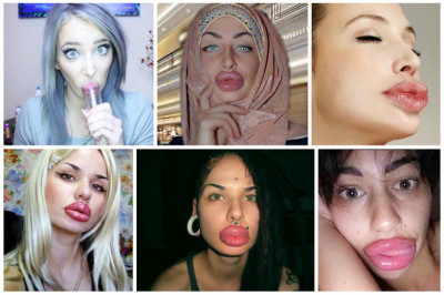 Зачем девушки увеличивают губы 