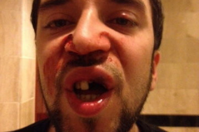 Посещать стоматолога следует регулярно!