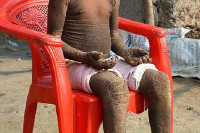 Мехенд Хасан - каменный мальчик 