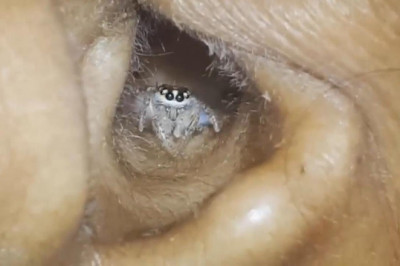 Паук в ухе женщины 