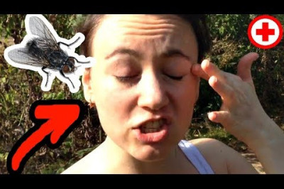 Муха в глаз попала